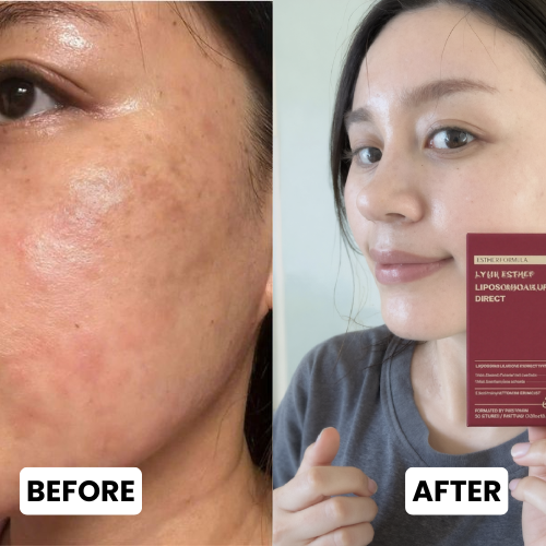 ESTER FUSION™ Liposome Glutathione Direct Strips