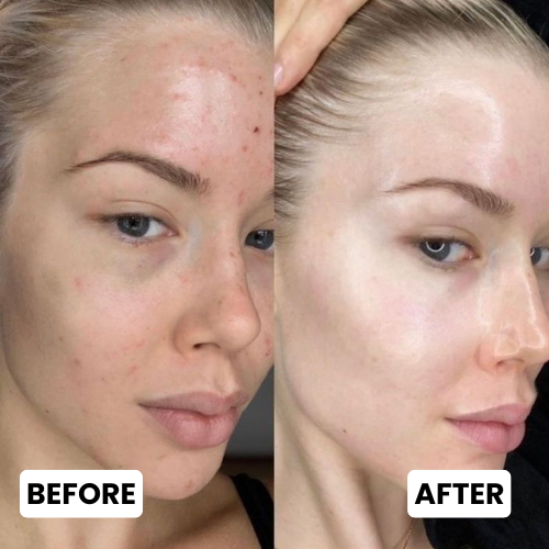 ESTER FUSION™ Liposome Glutathione Direct Strips
